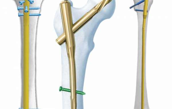 The Best Orthopedic Device Manufacturers